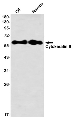 Cytokeratin 9 Rabbit mAb
