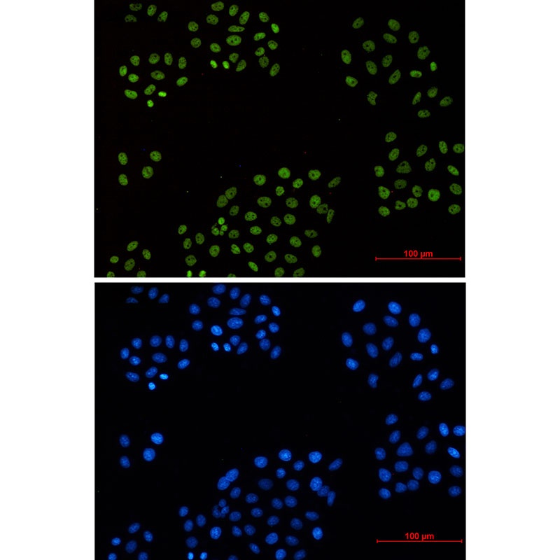 Cyclin H Rabbit mAb