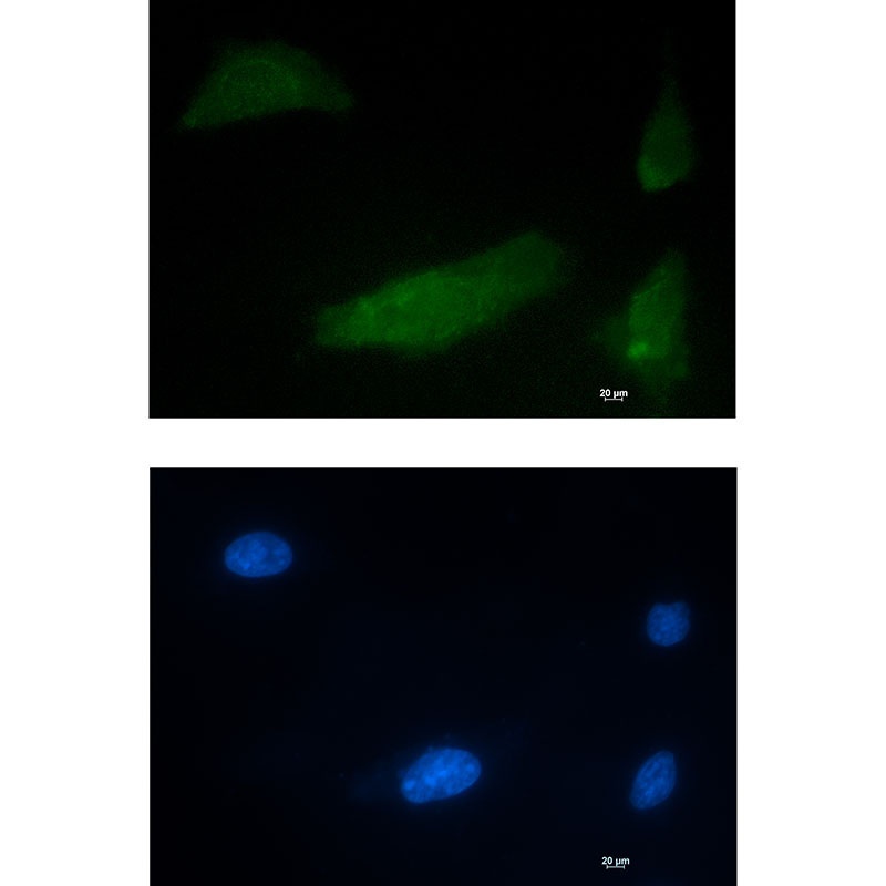 CUG BP1 Rabbit mAb