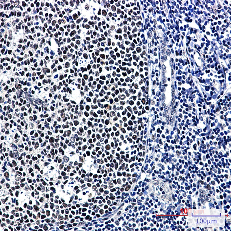 CUG BP1 Rabbit mAb