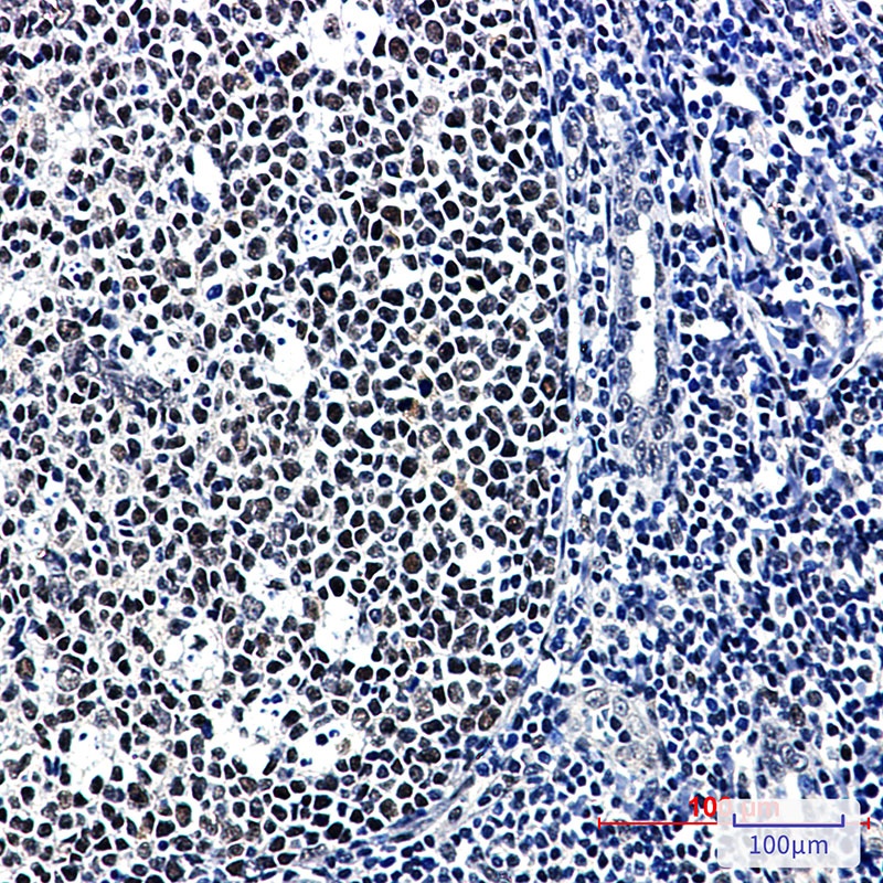 CELF1 Antibody