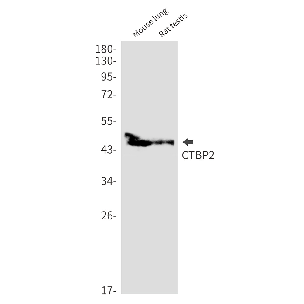 CTBP2 Rabbit mAb