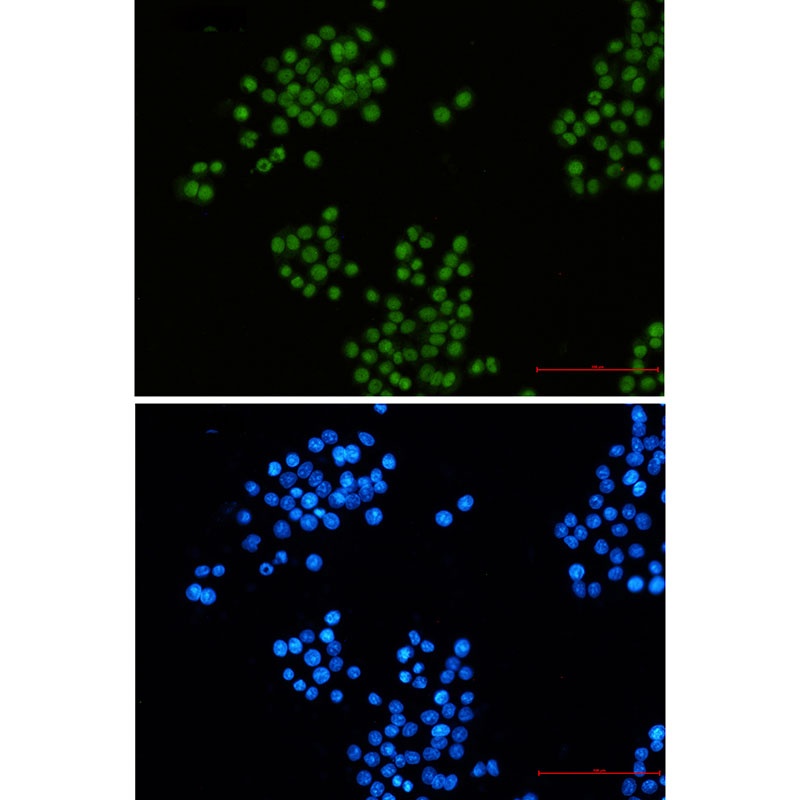 CTBP2 Rabbit mAb
