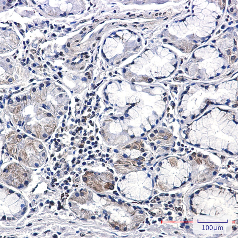 CSDE1 Antibody