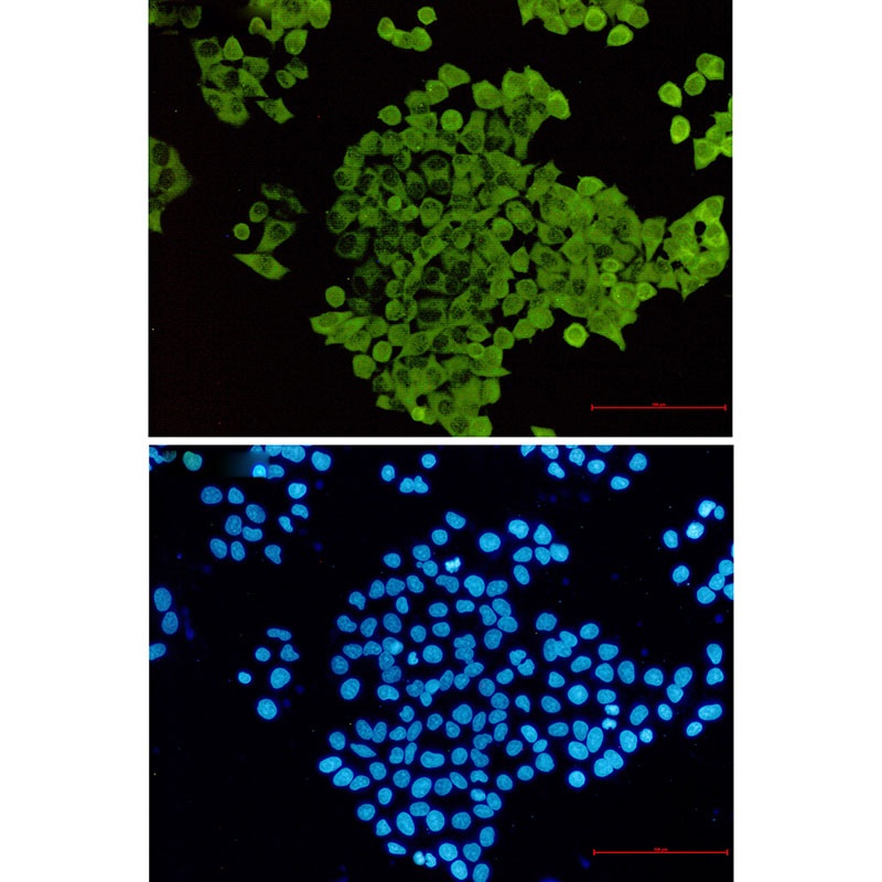 [KO] Cofilin Rabbit mAb