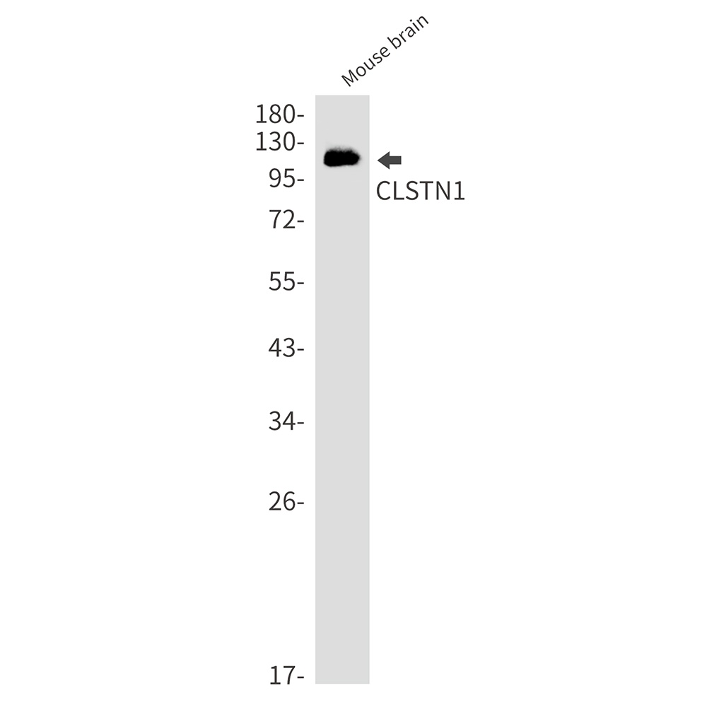 CLSTN1 Rabbit mAb
