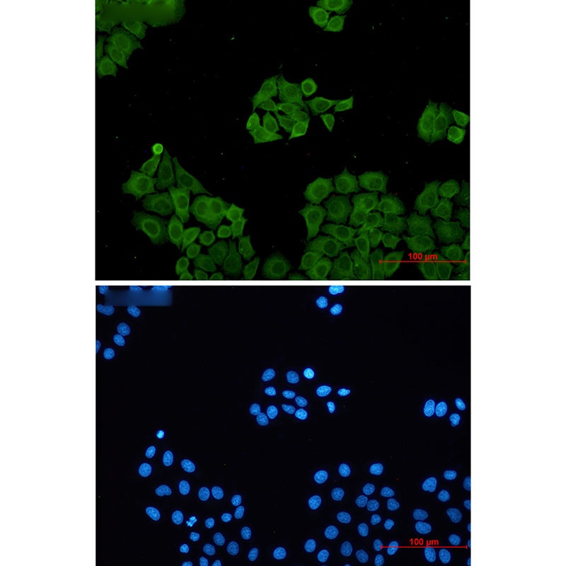 CLIC1 Antibody