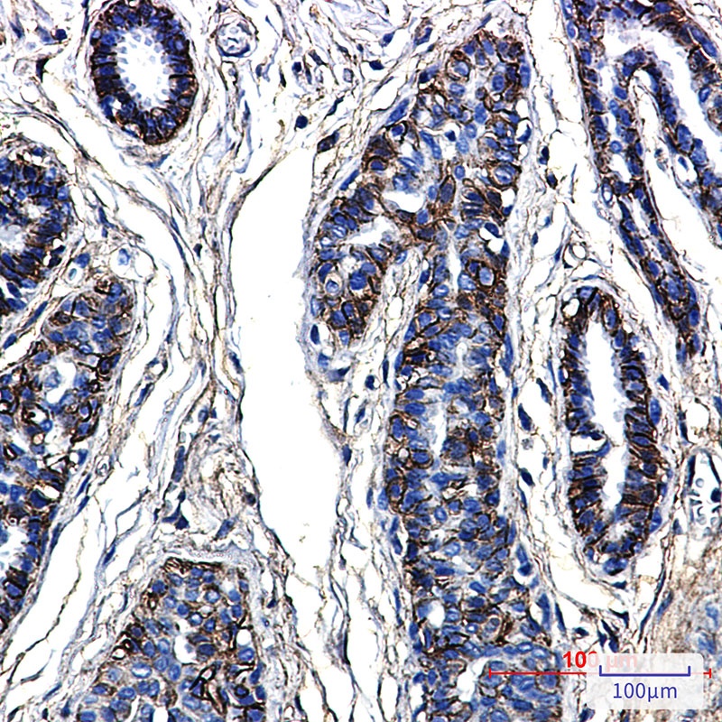 CD99 Rabbit mAb