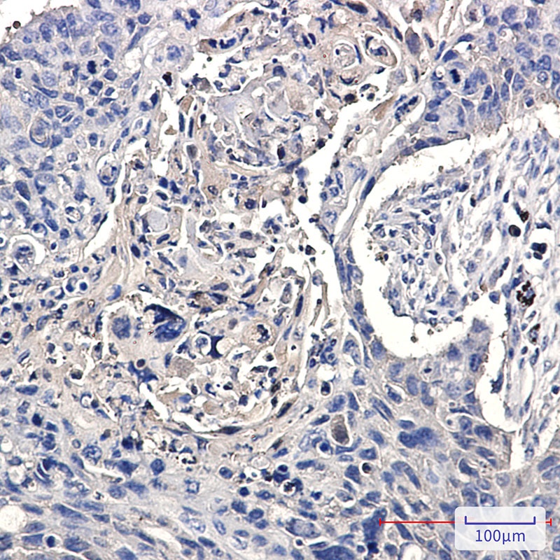CCT2 Rabbit mAb
