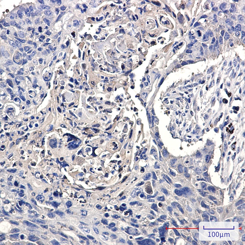 CCT2 Antibody