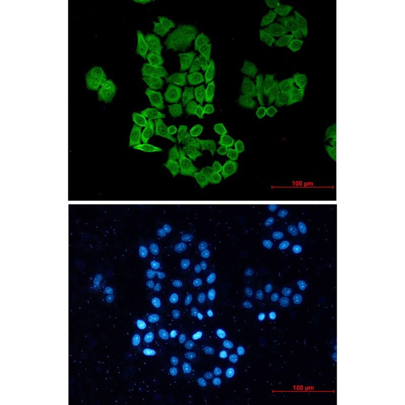 CCT2 Rabbit mAb