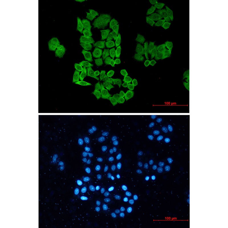 CCT2 Antibody