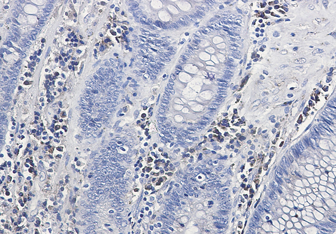 Calumenin Rabbit Monoclonal Antibody