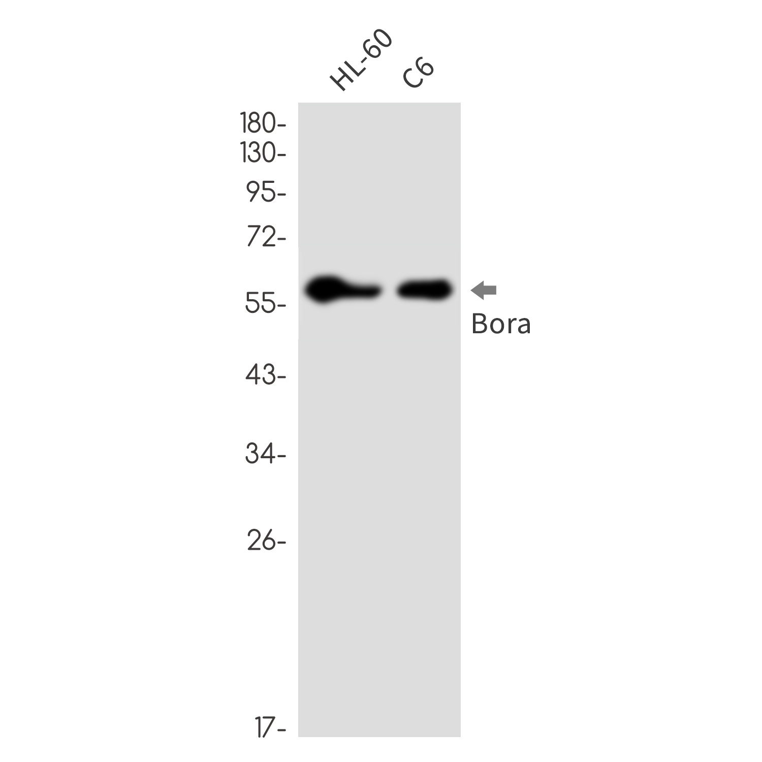 Caldesmon Rabbit mAb