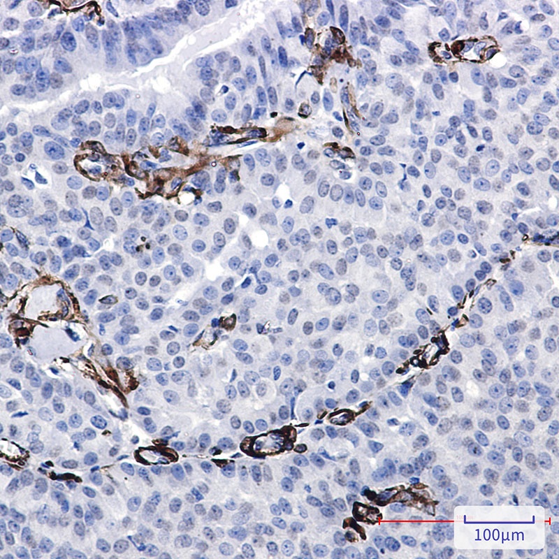 Caldesmon Rabbit mAb