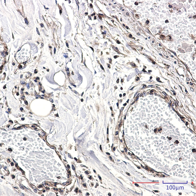 CAB39 Rabbit mAb