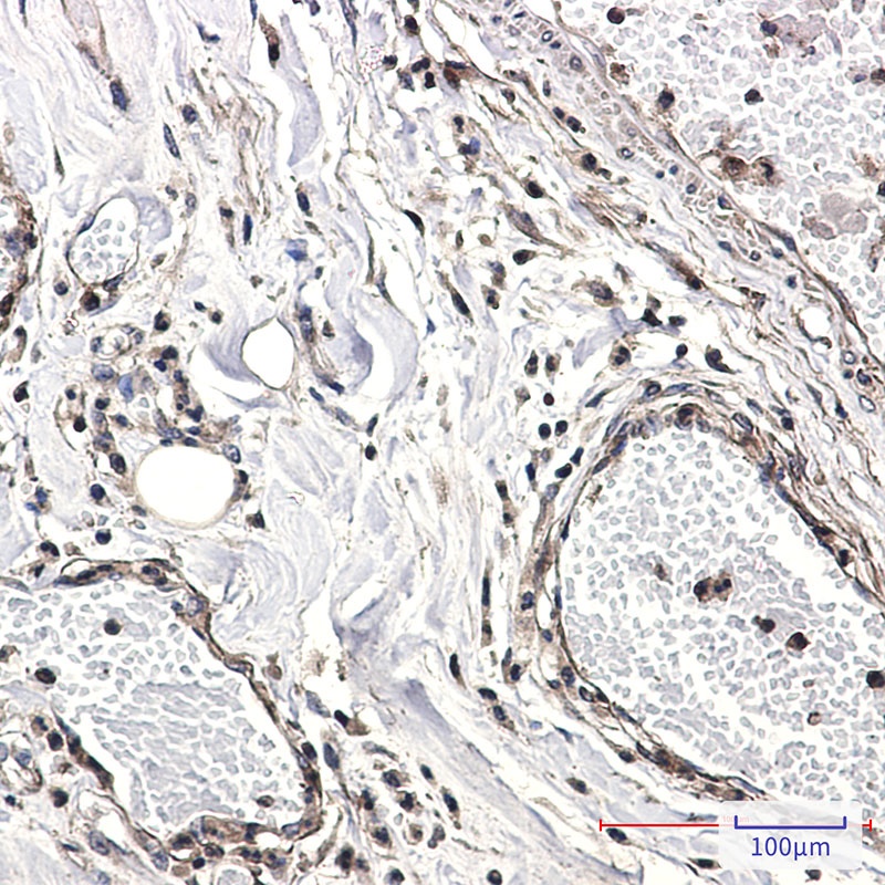 CAB39 Antibody