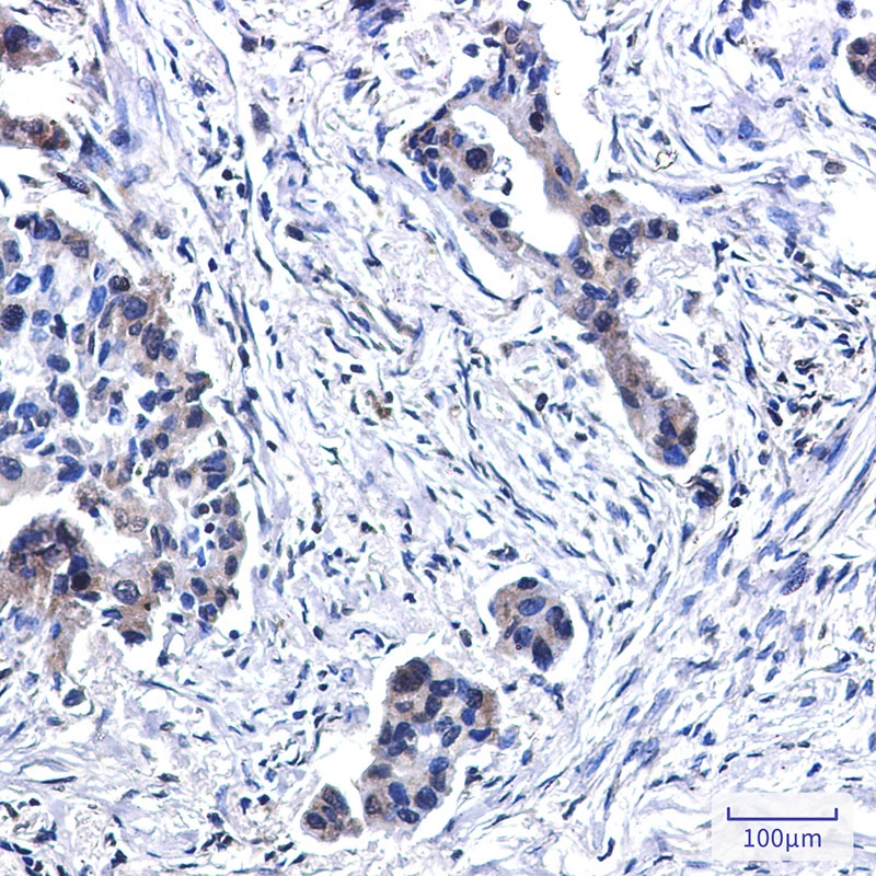 BUBR1 Rabbit mAb