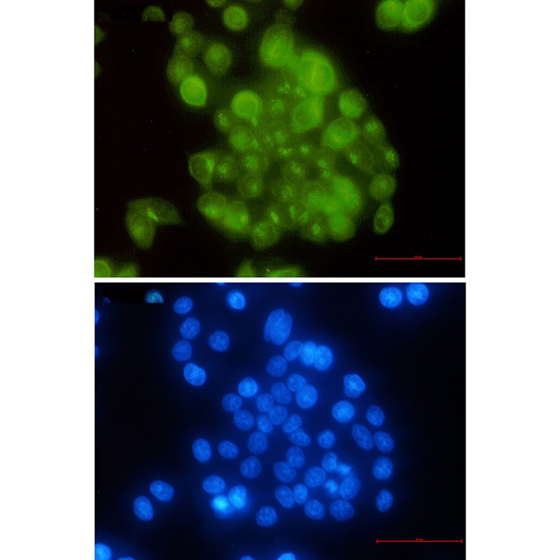 BUB1B Antibody