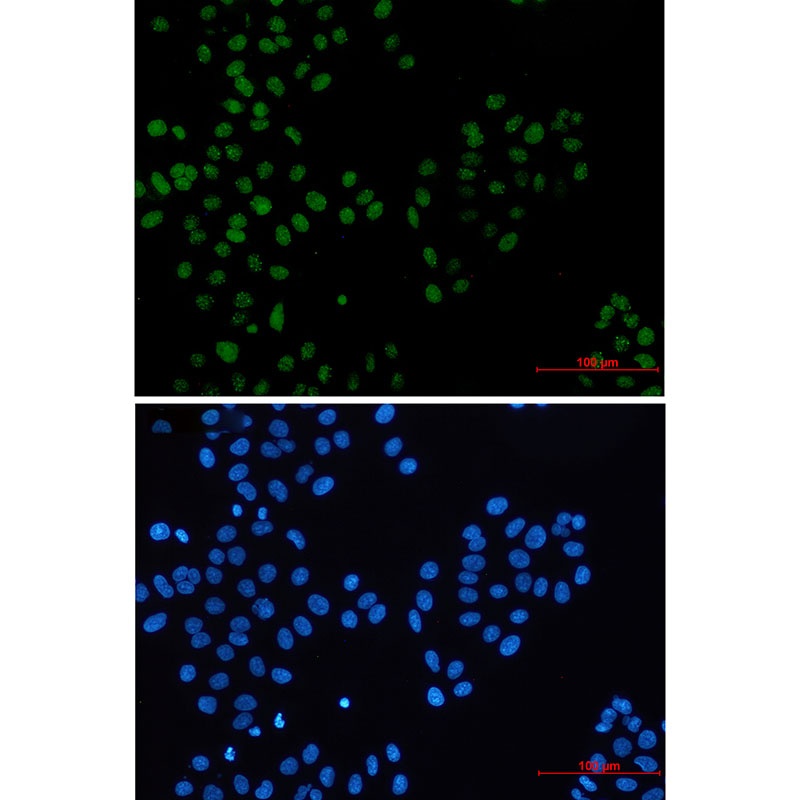 BMI1 Antibody