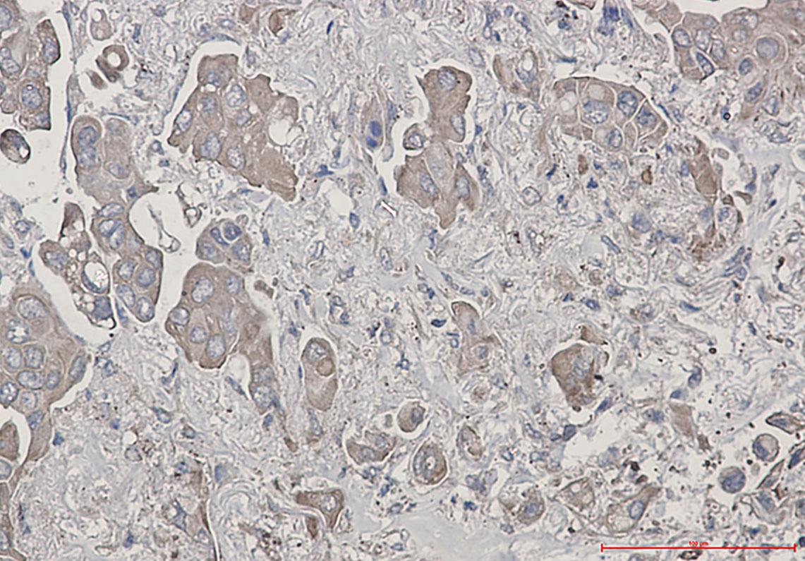 Bid Rabbit mAb
