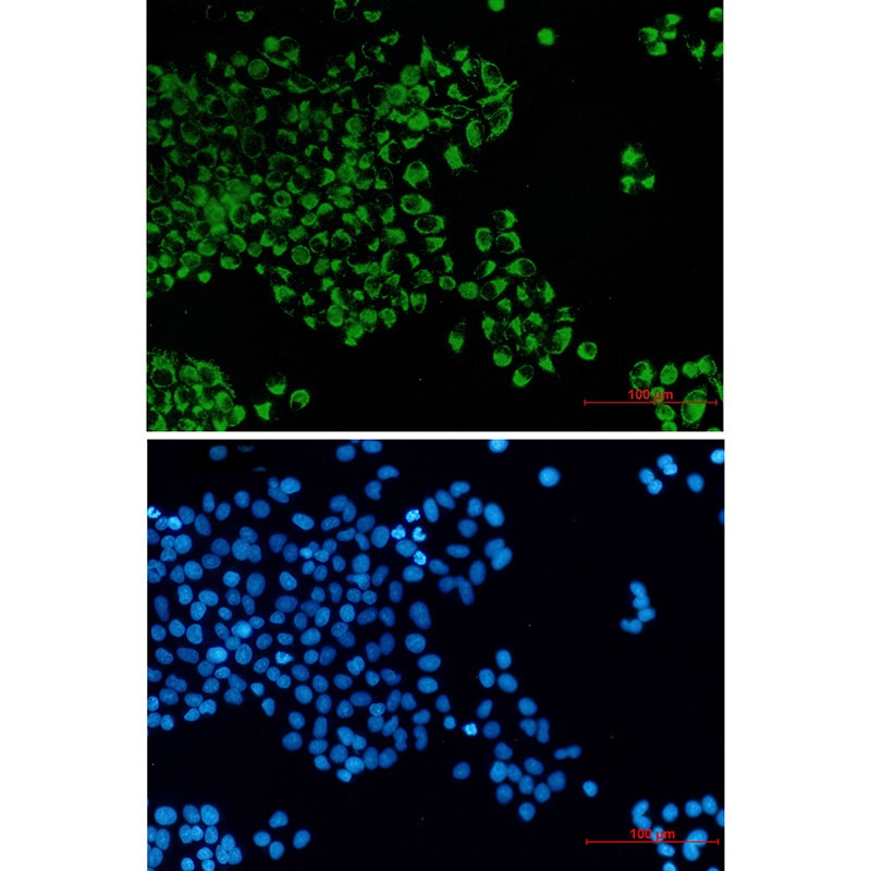 Bcl2 L14 Rabbit mAb