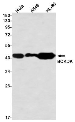 BCKDK Rabbit Monoclonal Antibody