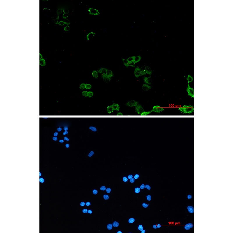 AMPK gamma 1 Rabbit mAb
