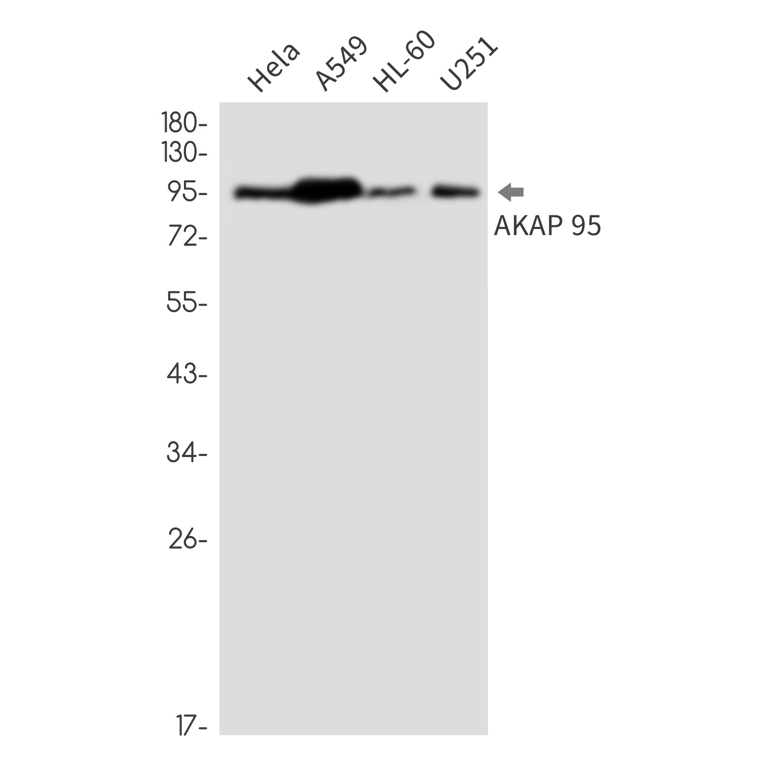 AKAP8 Antibody