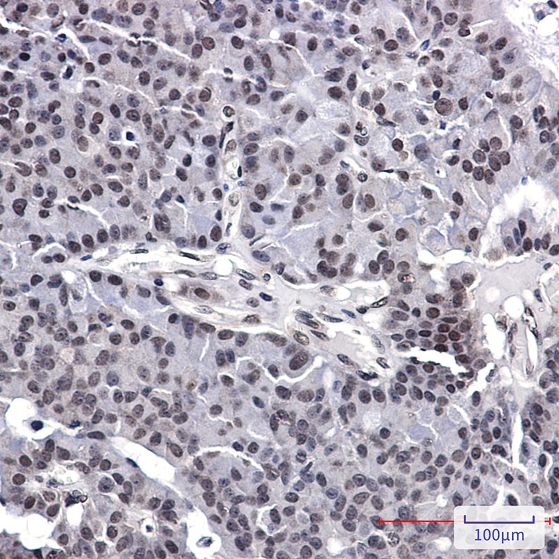 AKAP8 Antibody