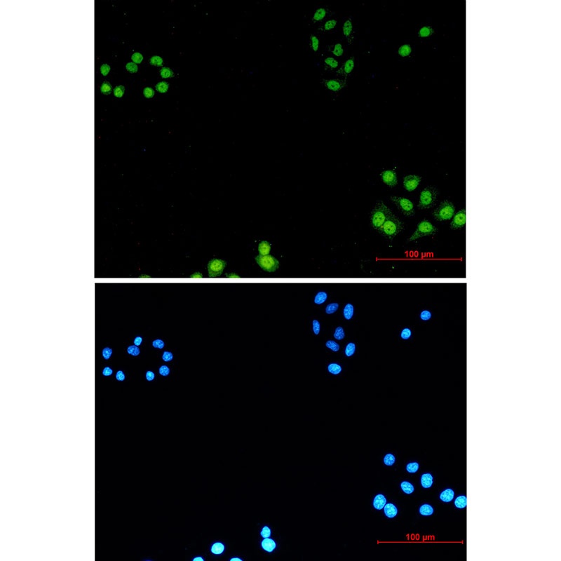 AKAP8 Antibody
