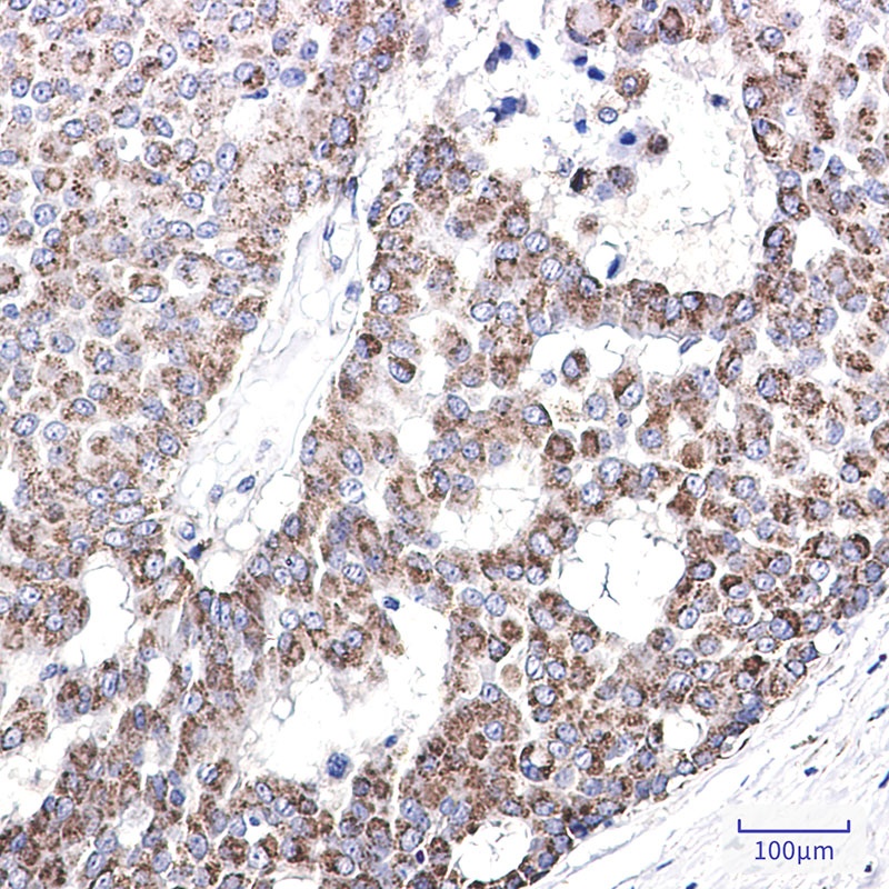AK4 Antibody