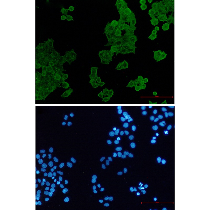 ACTR1B Antibody