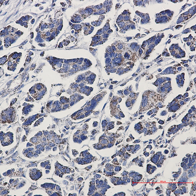 ACO2 Antibody