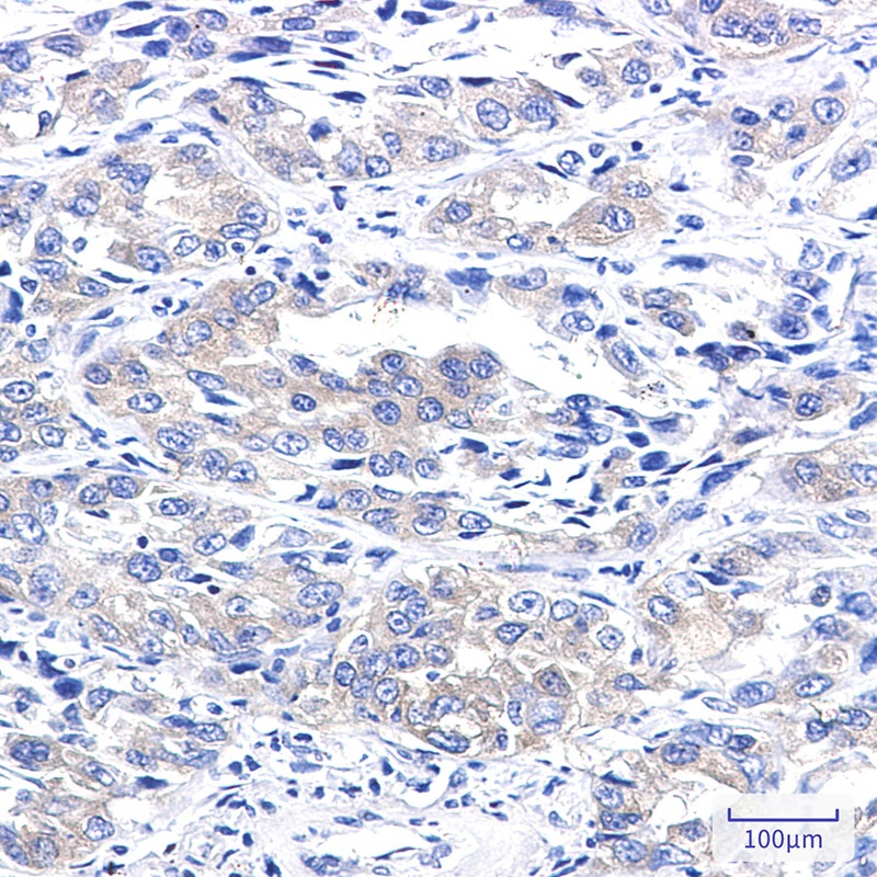 A RAF Rabbit mAb