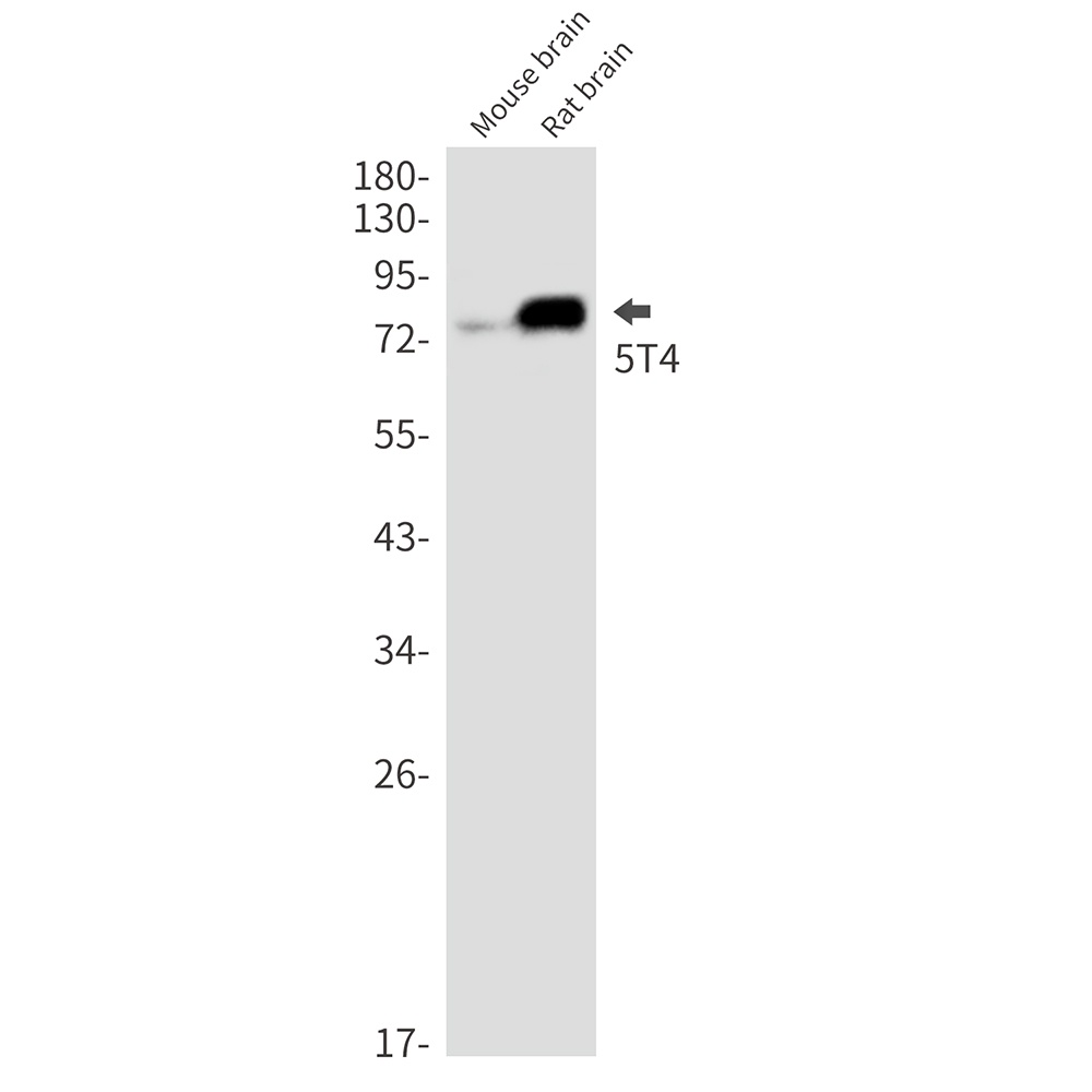 TPBG Antibody