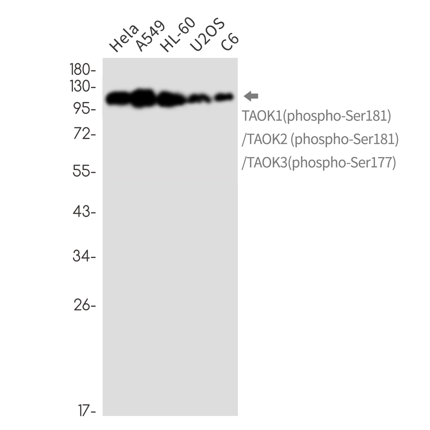 Phospho-TAOK1/2/3 (Ser181/Ser181/Ser177) Rabbit mAb
