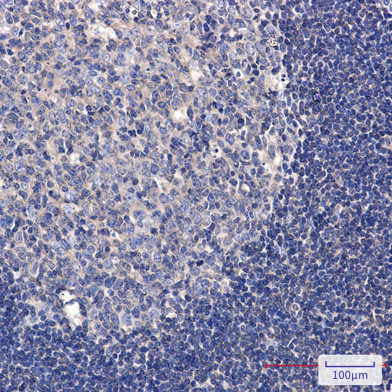 Phospho-TAOK1/2/3 (Ser181/Ser181/Ser177) Rabbit mAb