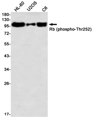 RB1 Antibody