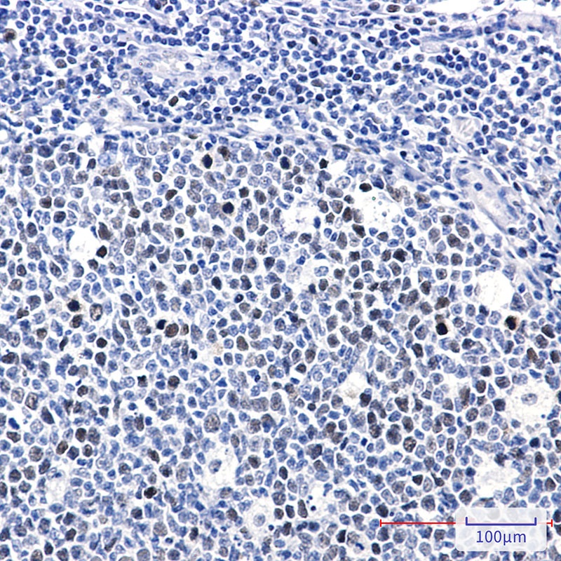 RB1 Antibody