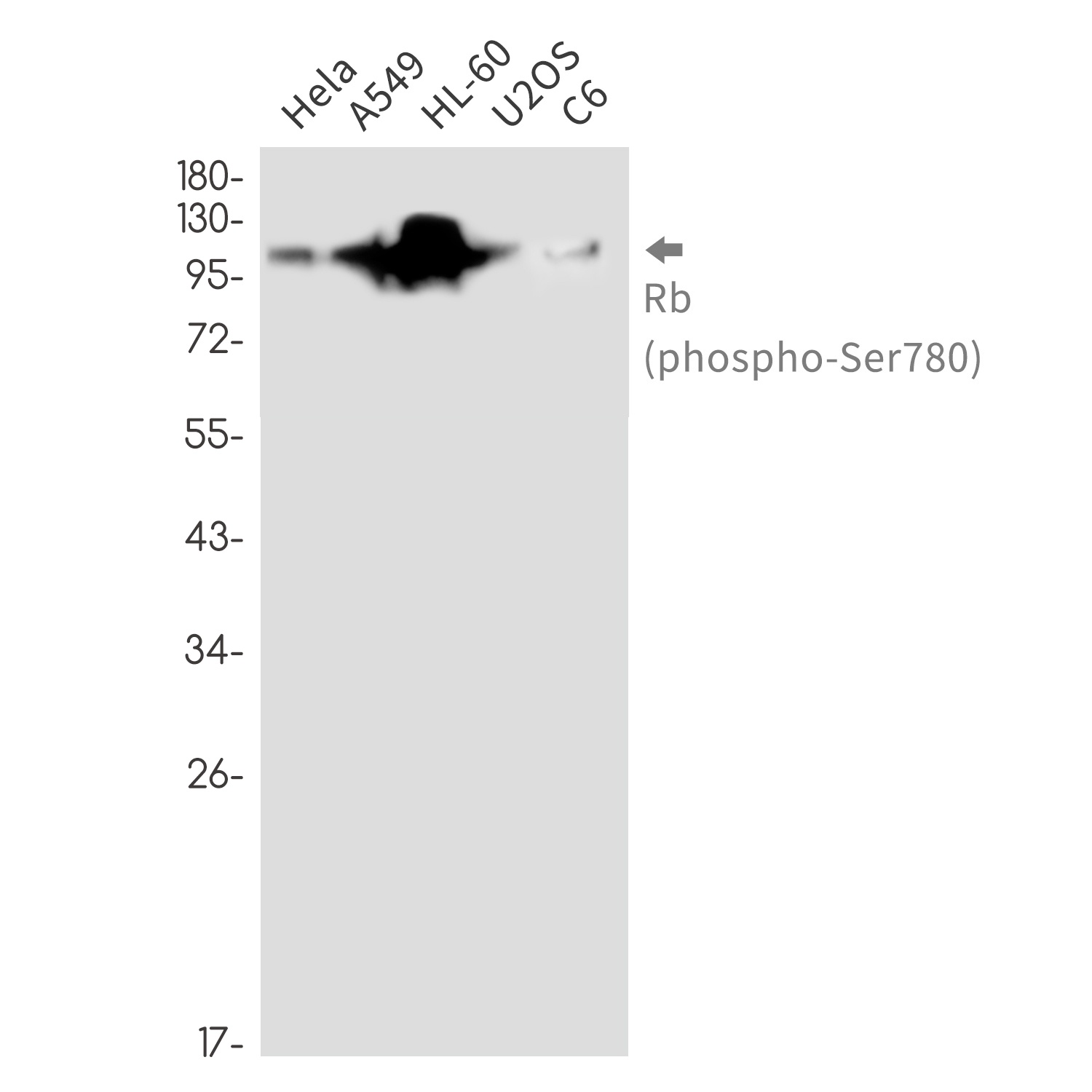 RB1 Antibody
