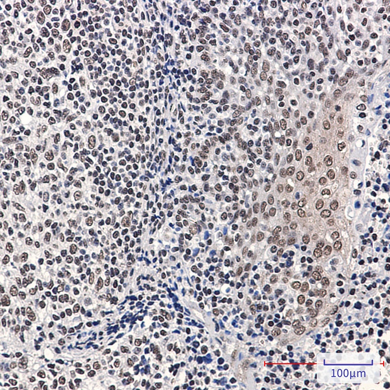 RB1 Antibody