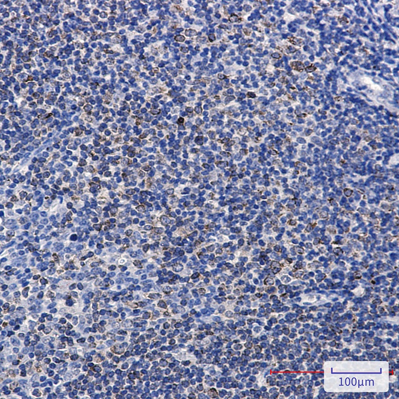 Phospho-PTP1B (Ser378) Rabbit Monoclonal Antibody