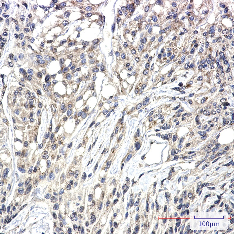 Phospho-PKC zeta/lambda (Thr410/Thr412) Rabbit mAb