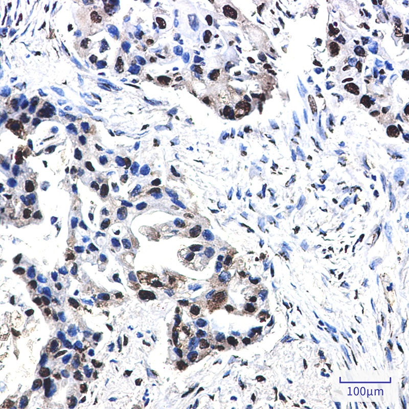 NPM1 Antibody