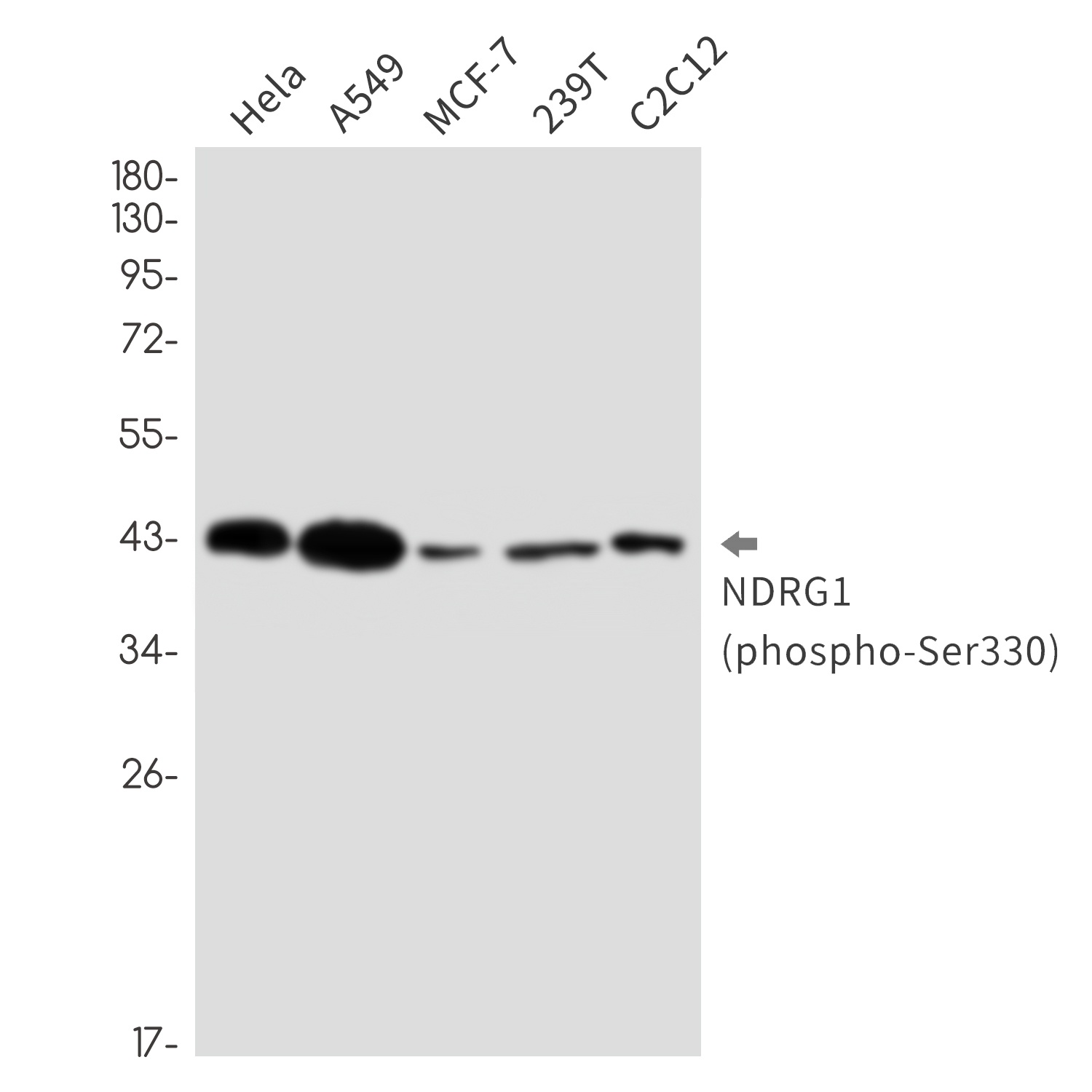 [KO] Phospho-NDRG1 (Ser330) Rabbit mAb