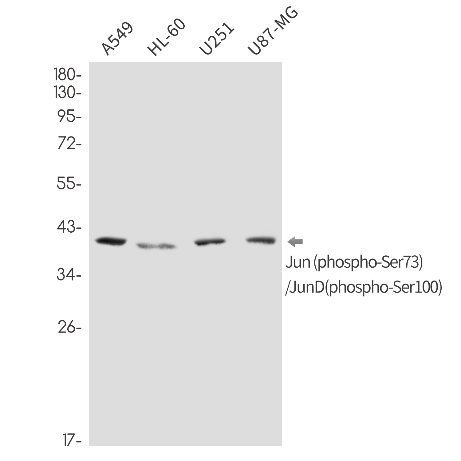 Phospho-Jun/JunD (Ser73/Ser100) Rabbit mAb