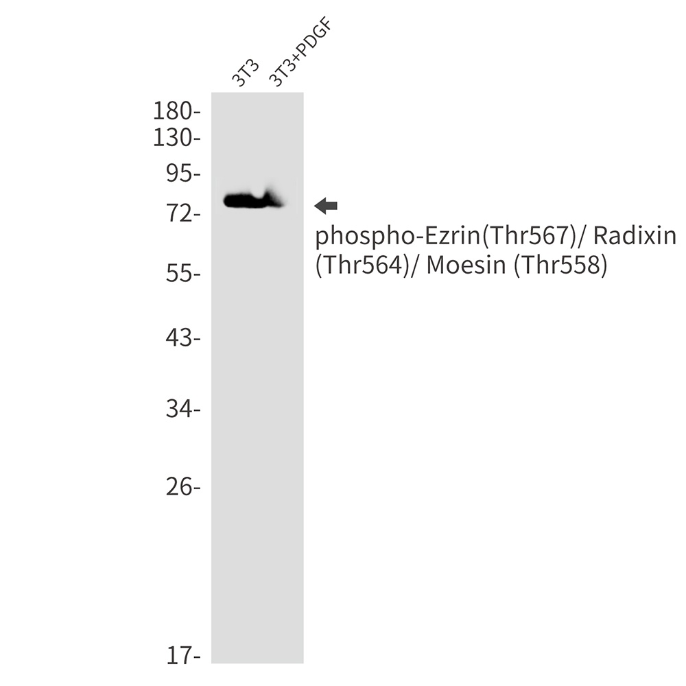 Phospho-Ezrin/Radixin/Moesin (Thr567/Thr564/Thr558) Rabbit mAb