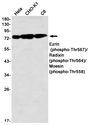 Phospho-Ezrin/Radixin/Moesin (Thr567/Thr564/Thr558) Rabbit mAb