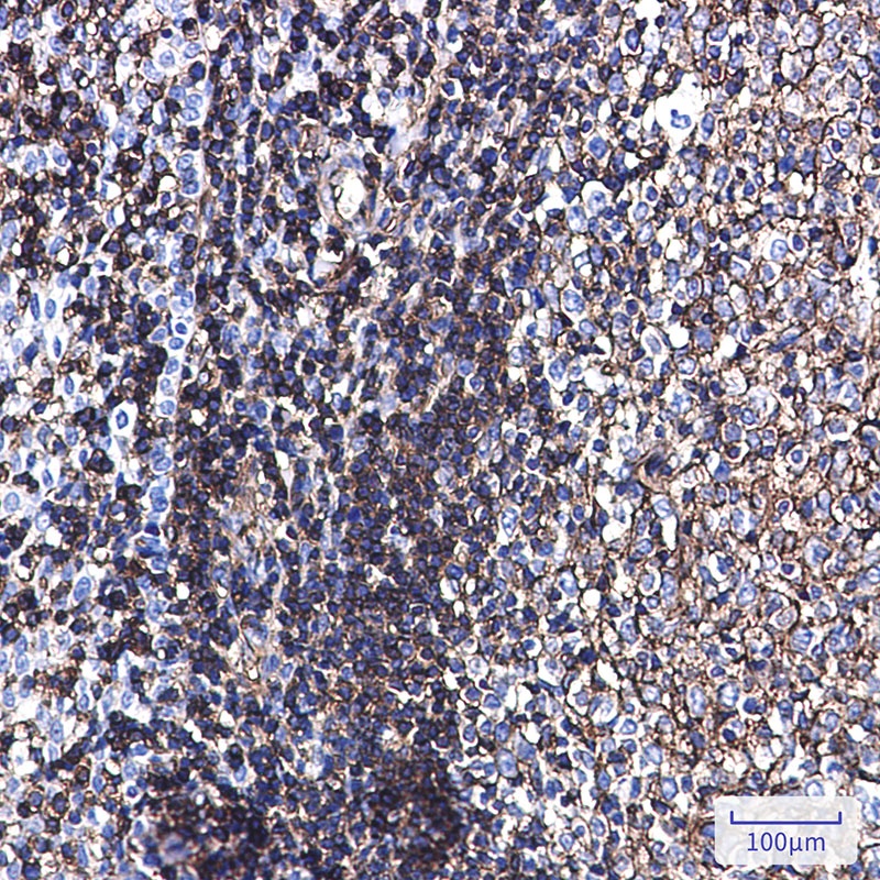 Phospho-Ezrin/Radixin/Moesin (Thr567/Thr564/Thr558) Rabbit mAb